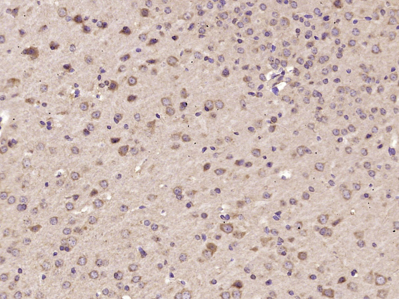 Paraformaldehyde-fixed, paraffin embedded Mouse brain; Antigen retrieval by boiling in sodium citrate buffer (pH6.0) for 15min; Block endogenous peroxidase by 3% hydrogen peroxide for 20 minutes; Blocking buffer (normal goat serum) at 37°C for 30min; Antibody incubation with STAT6 Polyclonal Antibody, Unconjugated (bs-1143R) at 1:400 overnight at 4°C, DAB staining. Paraformaldehyde-fixed, paraffin embedded Mouse brain; Antigen retrieval by boiling in sodium citrate buffer (pH6.0) for 15min; Block endogenous peroxidase by 3% hydrogen peroxide for 20 minutes; Blocking buffer (normal goat serum) at 37°C for 30min; Antibody incubation with STAT6 Polyclonal Antibody, Unconjugated (bs-1143R) at 1:400 overnight at 4°C, DAB staining.