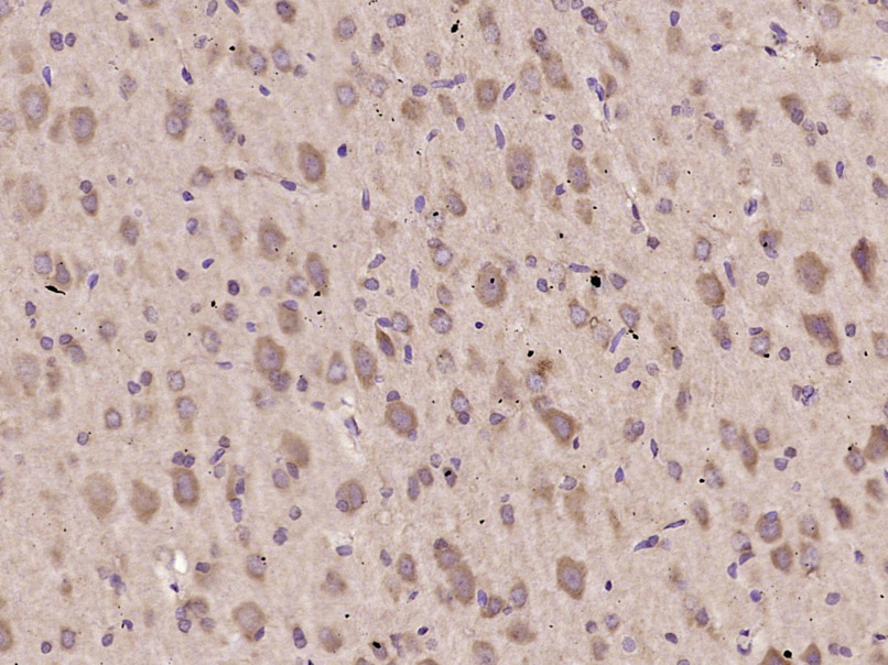Paraformaldehyde-fixed, paraffin embedded Rat brain; Antigen retrieval by boiling in sodium citrate buffer (pH6.0) for 15min; Block endogenous peroxidase by 3% hydrogen peroxide for 20 minutes; Blocking buffer (normal goat serum) at 37°C for 30min; Antibody incubation with STAT6 Polyclonal Antibody, Unconjugated (bs-1143R) at 1:400 overnight at 4°C, DAB staining. Paraformaldehyde-fixed, paraffin embedded Rat brain; Antigen retrieval by boiling in sodium citrate buffer (pH6.0) for 15min; Block endogenous peroxidase by 3% hydrogen peroxide for 20 minutes; Blocking buffer (normal goat serum) at 37°C for 30min; Antibody incubation with STAT6 Polyclonal Antibody, Unconjugated (bs-1143R) at 1:400 overnight at 4°C, DAB staining.