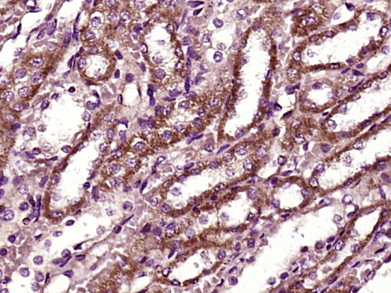 Paraformaldehyde-fixed, paraffin embedded Rat kidney; Antigen retrieval by boiling in sodium citrate buffer (pH6.0) for 15min; Block endogenous peroxidase by 3% hydrogen peroxide for 20 minutes; Blocking buffer (normal goat serum) at 37°C for 30min; Antibody incubation with BBS9 Polyclonal Antibody, Unconjugated (bs-11511R) at 1:400 overnight at 4°C, DAB staining.