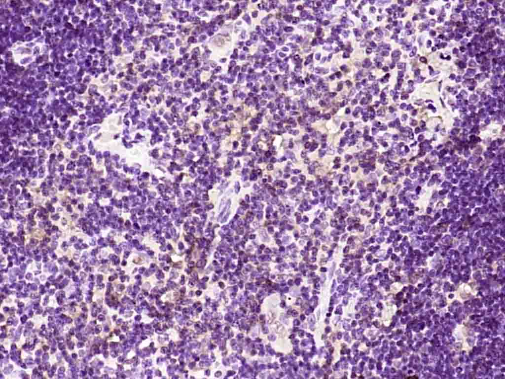 Paraformaldehyde-fixed, paraffin embedded Rat thymus; Antigen retrieval by boiling in sodium citrate buffer (pH6.0) for 15min; Block endogenous peroxidase by 3% hydrogen peroxide for 20 minutes; Blocking buffer (normal goat serum) at 37°C for 30min; Antibody incubation with Gemin 2/SMA Polyclonal Antibody, Unconjugated (bs-11562R) at 1:200 overnight at 4°C, DAB staining.