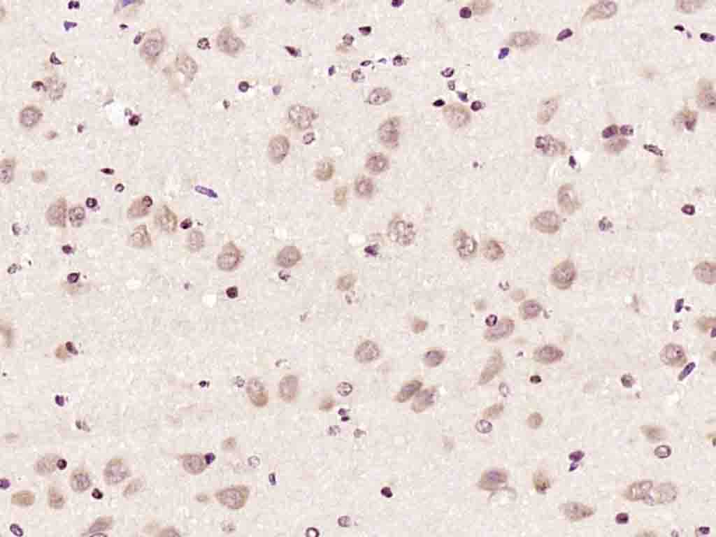 Paraformaldehyde-fixed, paraffin embedded Rat brain; Antigen retrieval by boiling in sodium citrate buffer (pH6.0) for 15min; Block endogenous peroxidase by 3% hydrogen peroxide for 20 minutes; Blocking buffer (normal goat serum) at 37°C for 30min; Antibody incubation with Gemin 2/SMA Polyclonal Antibody, Unconjugated (bs-11562R) at 1:200 overnight at 4°C, DAB staining.