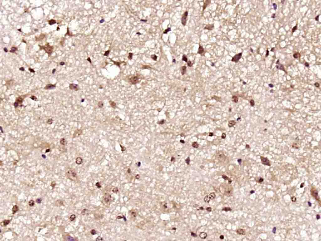 Paraformaldehyde-fixed, paraffin embedded Rat spinal cord; Antigen retrieval by boiling in sodium citrate buffer (pH6.0) for 15min; Block endogenous peroxidase by 3% hydrogen peroxide for 20 minutes; Blocking buffer (normal goat serum) at 37°C for 30min; Antibody incubation with Gemin 2/SMA Polyclonal Antibody, Unconjugated (bs-11562R) at 1:200 overnight at 4°C, DAB staining.