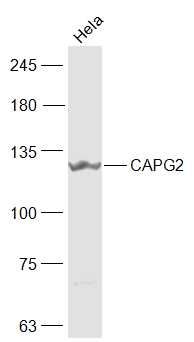 Lane 1: Hela cell lysates probed with CAPG2 Polyclonal Antibody, Unconjugated (bs-7721R) at 1:1000 dilution and 4˚C overnight incubation. Followed by conjugated secondary antibody incubation at 1:20000 for 60 min at 37˚C.