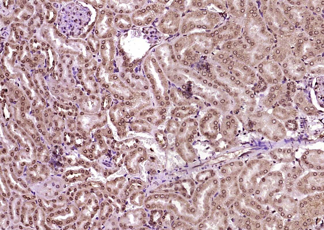 Paraformaldehyde-fixed, paraffin embedded Mouse kidney; Antigen retrieval by boiling in sodium citrate buffer (pH6.0) for 15min; Block endogenous peroxidase by 3% hydrogen peroxide for 20 minutes; Blocking buffer (normal goat serum) at 37°C for 30min; Antibody incubation with KIBRA Polyclonal Antibody, Unconjugated (bs-11570R) at 1:400 overnight at 4°C, DAB staining.