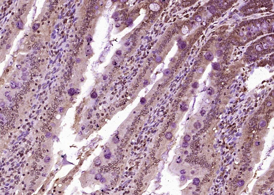 Paraformaldehyde-fixed, paraffin embedded Rat small intestine; Antigen retrieval by boiling in sodium citrate buffer (pH6.0) for 15min; Block endogenous peroxidase by 3% hydrogen peroxide for 20 minutes; Blocking buffer (normal goat serum) at 37°C for 30min; Antibody incubation with KIBRA Polyclonal Antibody, Unconjugated (bs-11570R) at 1:400 overnight at 4°C, DAB staining.