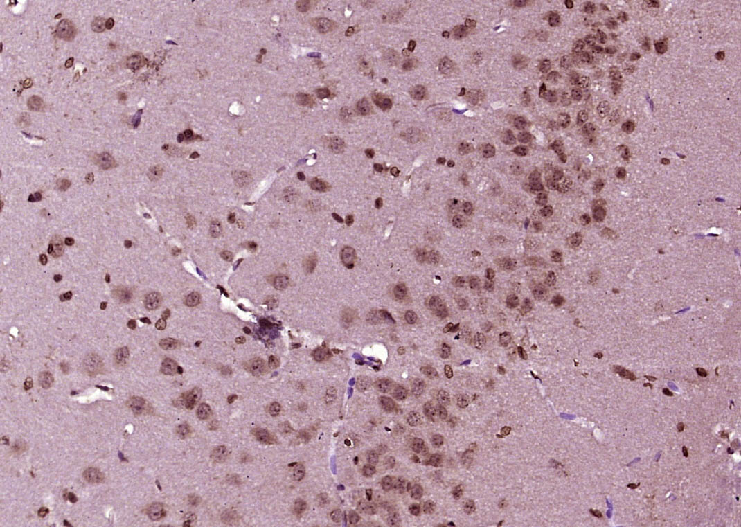 Paraformaldehyde-fixed, paraffin embedded Rat brain; Antigen retrieval by boiling in sodium citrate buffer (pH6.0) for 15min; Block endogenous peroxidase by 3% hydrogen peroxide for 20 minutes; Blocking buffer (normal goat serum) at 37°C for 30min; Antibody incubation with KIBRA Polyclonal Antibody, Unconjugated (bs-11570R) at 1:400 overnight at 4°C, DAB staining.