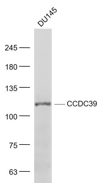 Lane 1: DU145 cell lysates probed with CCDC39 Polyclonal Antibody, Unconjugated (bs-8096R) at 1:1000 dilution and 4˚C overnight incubation. Followed by conjugated secondary antibody incubation at 1:20000 for 60 min at 37˚C.