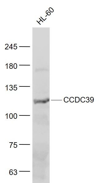 Lane 1: HL-60 cell lysates probed with CCDC39 Polyclonal Antibody, Unconjugated (bs-8096R) at 1:1000 dilution and 4˚C overnight incubation. Followed by conjugated secondary antibody incubation at 1:20000 for 60 min at 37˚C.