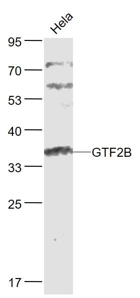 Lane 1: Hela cell lysates probed with GTF2B Polyclonal Antibody, Unconjugated (bs-8168R) at 1:1000 dilution and 4˚C overnight incubation. Followed by conjugated secondary antibody incubation at 1:20000 for 60 min at 37˚C.