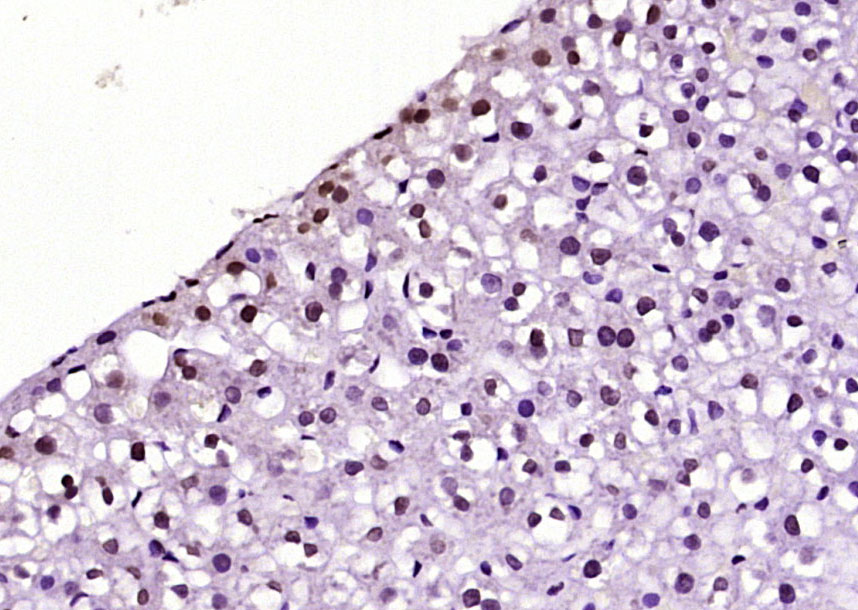 Paraformaldehyde-fixed, paraffin embedded Rat liver; Antigen retrieval by boiling in sodium citrate buffer (pH6.0) for 15min; Block endogenous peroxidase by 3% hydrogen peroxide for 20 minutes; Blocking buffer (normal goat serum) at 37°C for 30min; Antibody incubation with BPTF/FALZ Polyclonal Antibody, Unconjugated (bs-11641R) at 1:200 overnight at 4°C, DAB staining.