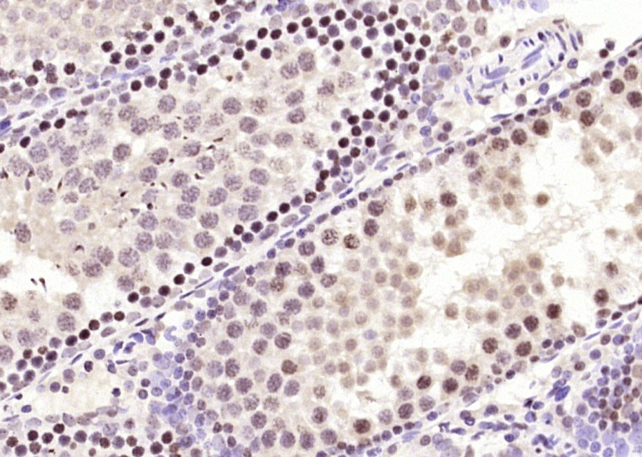 Paraformaldehyde-fixed, paraffin embedded Rat testis; Antigen retrieval by boiling in sodium citrate buffer (pH6.0) for 15min; Block endogenous peroxidase by 3% hydrogen peroxide for 20 minutes; Blocking buffer (normal goat serum) at 37°C for 30min; Antibody incubation with BPTF/FALZ Polyclonal Antibody, Unconjugated (bs-11641R) at 1:200 overnight at 4°C, DAB staining.