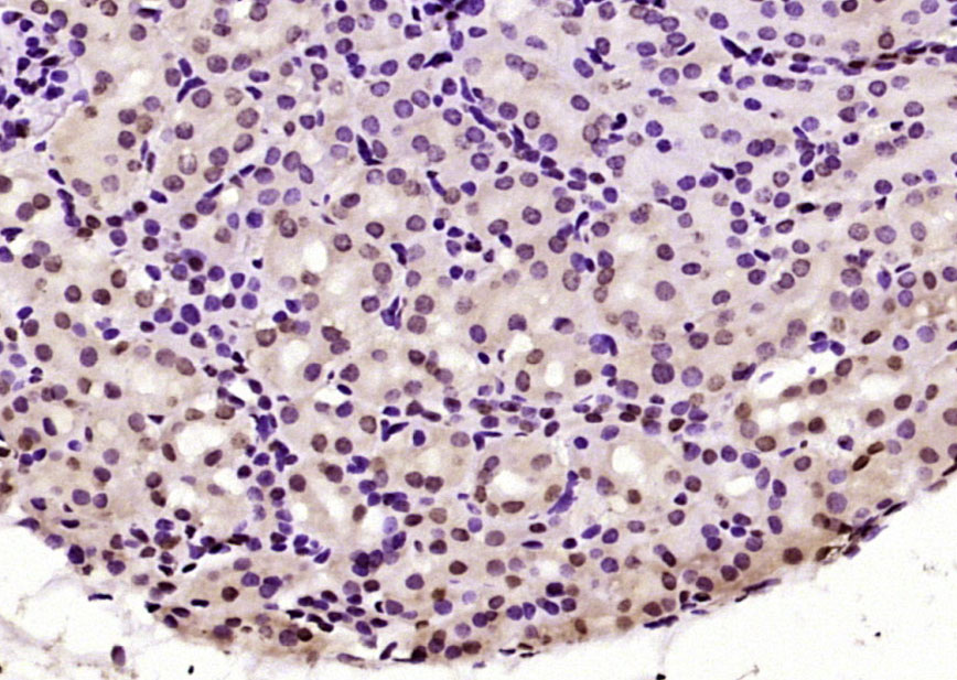 Paraformaldehyde-fixed, paraffin embedded Mouse kidney; Antigen retrieval by boiling in sodium citrate buffer (pH6.0) for 15min; Block endogenous peroxidase by 3% hydrogen peroxide for 20 minutes; Blocking buffer (normal goat serum) at 37°C for 30min; Antibody incubation with BPTF/FALZ Polyclonal Antibody, Unconjugated (bs-11641R) at 1:200 overnight at 4°C, DAB staining.