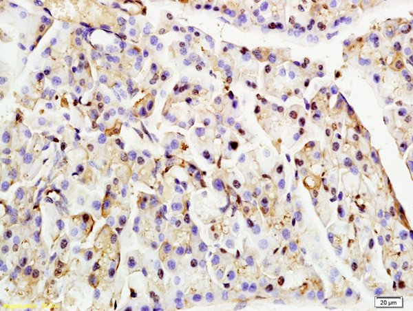 Formalin-fixed and paraffin embedded rat pancreas tissue labeled with Anti-Nucleoporin p62 Polyclonal Antibody, Unconjugated (bs-2935R) at 1:200 followed by conjugation to the secondary antibody