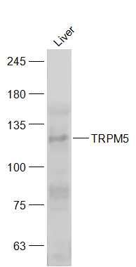 Lane 1: Human Liver cell lysates probed with TRPM5 Polyclonal Antibody, Unconjugated (bs-9047R) at 1:300 dilution and 4˚C overnight incubation. Followed by conjugated secondary antibody incubation at 1:20000 for 60 min at 37˚C.