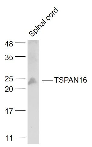 Lane 1: Mouse Spinal cord cell lysates probed with TSPAN16 Polyclonal Antibody, Unconjugated (bs-9423R) at 1:1000 dilution and 4˚C overnight incubation. Followed by conjugated secondary antibody incubation at 1:20000 for 60 min at 37˚C.
