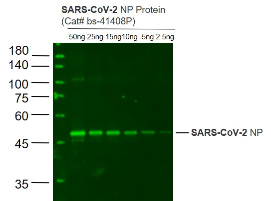 Lane 1: SARS-CoV-2 N protein(Cat# bs-41408P) at 50ng; Lane 2: SARS-CoV-2 N protein(Cat# bs-41408P) at 25ng; Lane 3: SARS-CoV-2 N protein(Cat# bs-41408P) at 15ng; Lane 4: SARS-CoV-2 N protein(Cat# bs-41408P) at 10ng ; Lane 5: SARS-CoV-2 N protein(Cat# bs-41408P) at 5ng;Lane 6: SARS-CoV-2 N protein(Cat# bs-41408P) at 2.5ng probed with SARS-CoV-2 N protein Polyclonal Antibody, Unconjugated (bs-41408R) at 1:1000 dilution and 4˚C overnight incubation. Followed by conjugated secondary antibody incubation at 1:20000 for 60 min at 37˚C.