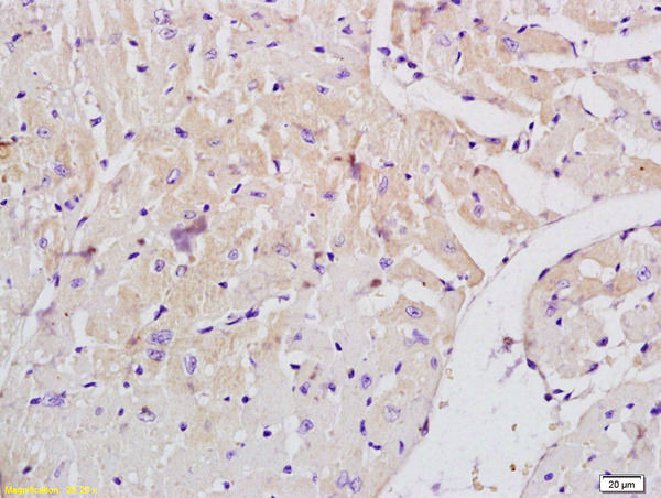 Formalin-fixed and paraffin embedded mouse heart labeled with Anti-MLK3/RHOE Polyclonal Antibody, Unconjugated (bs-2992R) at 1:200 followed by conjugation to the secondary antibody