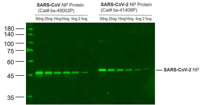 Lane 1: SARS-CoV N protein(Cat# bs-49002P) at 50ng; Lane 2: SARS-CoV N protein(Cat# bs-49002P) at 25ng; Lane 3: SARS-CoV N protein(Cat# bs-49002P) at 15ng; Lane 4: SARS-CoV N protein(Cat# bs-49002P) at 10ng ; Lane 5: SARS-CoV N protein(Cat# bs-49002P) at 5ng;Lane 6: SARS-CoV N protein(Cat# bs-49002P) at 2.5ng\uff1bLane 7: SARS-CoV-2 N protein(Cat# bs-41408P) at 50ng; Lane 8: SARS-CoV-2 N protein(Cat# bs-41408P) at 25ng; Lane 9: SARS-CoV-2 N protein(Cat# bs-41408P) at 15ng; Lane 10: SARS-CoV-2 N protein(Cat# bs-41408P) at 10ng ; Lane 11: SARS-CoV-2 N protein(Cat# bs-41408P) at 5ng;Lane 12: SARS-CoV-2 N protein(Cat# bs-41408P) at 2.5ng probed with SARS-CoV-2 N protein Polyclonal Antibody, Unconjugated (bs-41408R) at 1:1000 dilution and 4˚C overnight incubation. Followed by conjugated secondary antibody incubation at 1:20000 for 60 min at 37˚C.