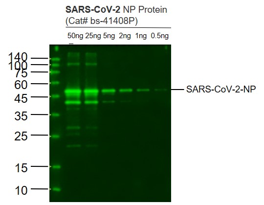 Lane 1: SARS-CoV-2 N protein(Cat# bs-41408P) at 50ng; Lane 2: SARS-CoV-2 N protein(Cat# bs-41408P) at 25ng; Lane 3: SARS-CoV-2 N protein(Cat# bs-41408P) at 5ng; Lane 4: SARS-CoV-2 N protein(Cat# bs-41408P) at 2ng ; Lane 5: SARS-CoV-2 N protein(Cat# bs-41408P) at 1ng;Lane 6: SARS-CoV-2 N protein(Cat# bs-41408P) at 0.5ng probed with SARS-CoV-2 N protein monoclonal Antibody, Unconjugated (bsm-41411M) at 1:1000 dilution and 4˚C overnight incubation. Followed by conjugated secondary antibody incubation at 1:20000 for 60 min at 37˚C.