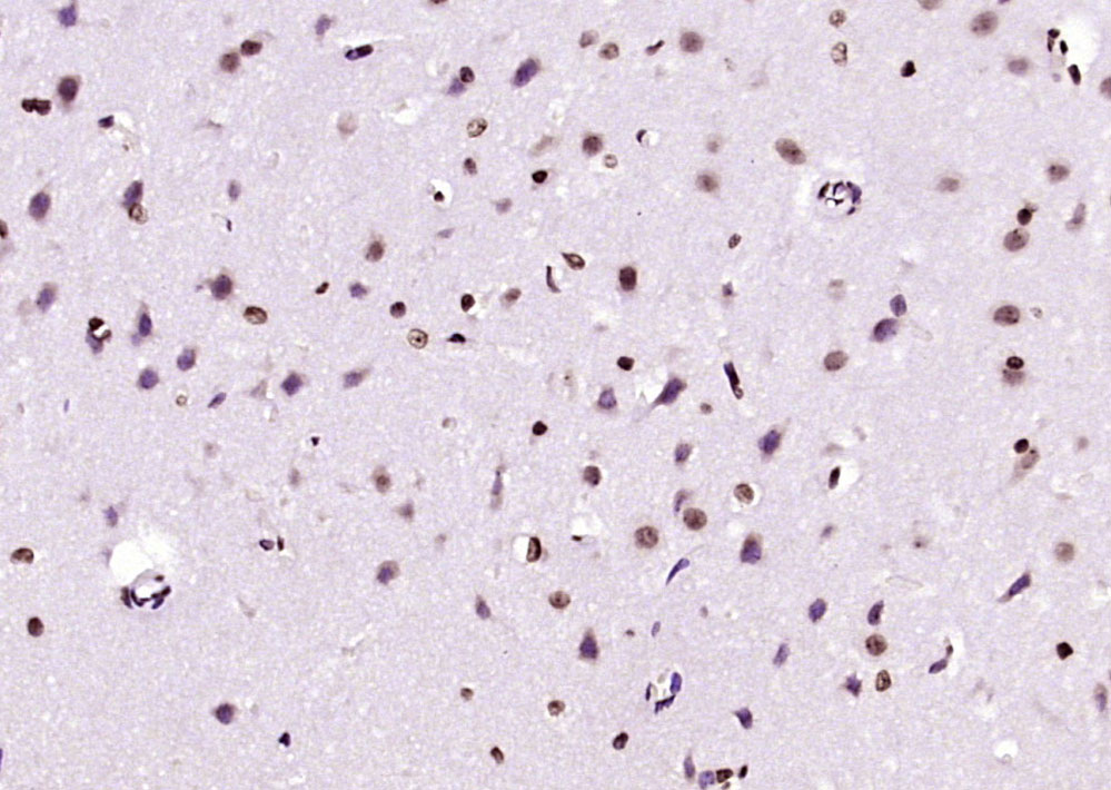 Paraformaldehyde-fixed, paraffin embedded Rat brain; Antigen retrieval by boiling in sodium citrate buffer (pH6.0) for 15min; Block endogenous peroxidase by 3% hydrogen peroxide for 20 minutes; Blocking buffer (normal goat serum) at 37°C for 30min; Antibody incubation with BPTF/FALZ Polyclonal Antibody, Unconjugated (bs-11641R) at 1:200 overnight at 4°C, DAB staining.