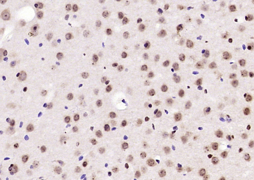 Paraformaldehyde-fixed, paraffin embedded Mouse brain; Antigen retrieval by boiling in sodium citrate buffer (pH6.0) for 15min; Block endogenous peroxidase by 3% hydrogen peroxide for 20 minutes; Blocking buffer (normal goat serum) at 37°C for 30min; Antibody incubation with BPTF/FALZ Polyclonal Antibody, Unconjugated (bs-11641R) at 1:200 overnight at 4°C, DAB staining.