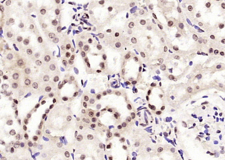 Paraformaldehyde-fixed, paraffin embedded Rat kidney; Antigen retrieval by boiling in sodium citrate buffer (pH6.0) for 15min; Block endogenous peroxidase by 3% hydrogen peroxide for 20 minutes; Blocking buffer (normal goat serum) at 37°C for 30min; Antibody incubation with BPTF/FALZ Polyclonal Antibody, Unconjugated (bs-11641R) at 1:200 overnight at 4°C, DAB staining.