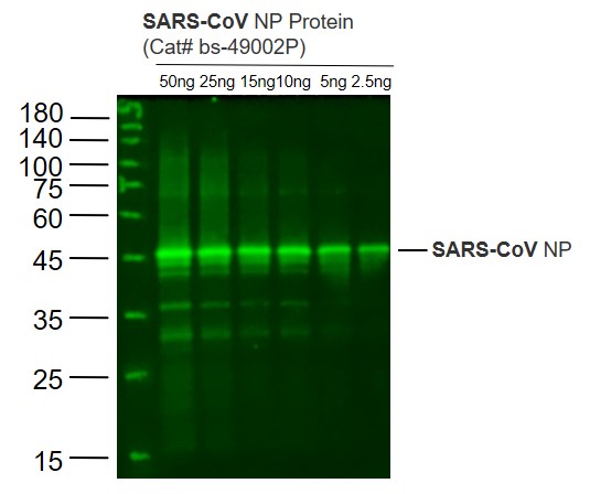 Lane 1: SARS-CoV N protein(Cat# bs-49002P) at 50ng; Lane 2: SARS-CoV N protein(Cat# bs-49002P) at 25ng; Lane 3: SARS-CoV N protein(Cat# bs-49002P) at 15ng; Lane 4: SARS-CoV N protein(Cat# bs-49002P) at 10ng ; Lane 5: SARS-CoV N protein(Cat# bs-49002P) at 5ng;Lane 6: SARS-CoV N protein(Cat# bs-49002P) at 2.5ng probed with SARS-CoV N protein Polyclonal Antibody, Unconjugated (bs-49002R) at 1:1000 dilution and 4˚C overnight incubation. Followed by conjugated secondary antibody incubation at 1:20000 for 60 min at 37˚C.