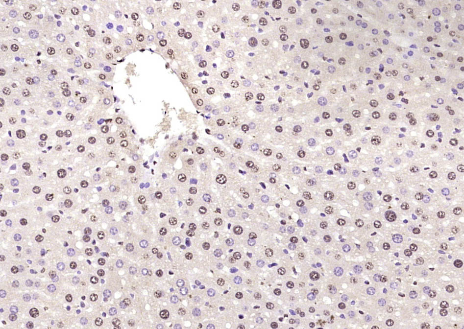 Paraformaldehyde-fixed, paraffin embedded Mouse liver; Antigen retrieval by boiling in sodium citrate buffer (pH6.0) for 15min; Block endogenous peroxidase by 3% hydrogen peroxide for 20 minutes; Blocking buffer (normal goat serum) at 37°C for 30min; Antibody incubation with FGGY Polyclonal Antibody, Unconjugated (bs-11689R) at 1:400 overnight at 4°C, DAB staining.