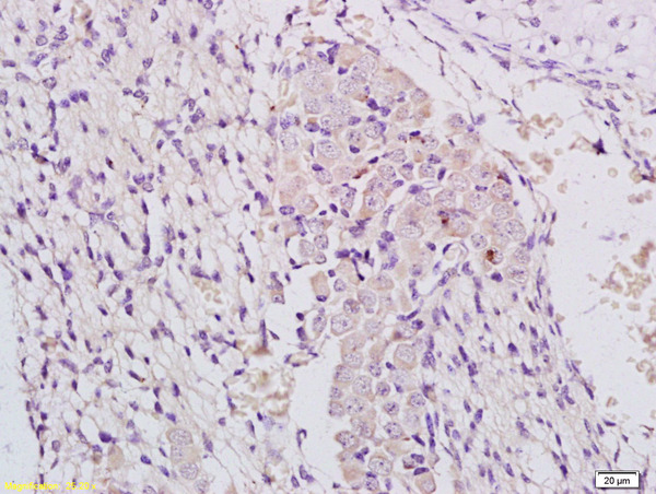 Formalin-fixed and paraffin embedded mouse embryo labeled with Anti-MLK3/RHOE Polyclonal Antibody, Unconjugated (bs-2992R) at 1:200 followed by conjugation to the secondary antibody