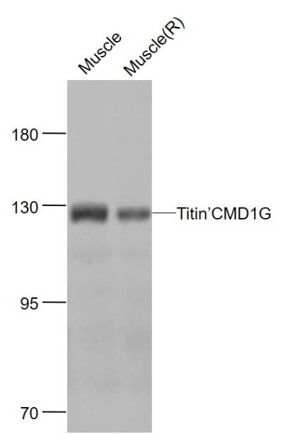 Lane 1: Mouse Muscle cell lysates; Lane 2: Rat Muscle cell lysates probed with Titin Polyclonal Antibody, Unconjugated (bs-9861R) at 1:1000 dilution and 4˚C overnight incubation. Followed by conjugated secondary antibody incubation at 1:20000 for 60 min at 37˚C. Lane 1: Mouse Muscle cell lysates; Lane 2: Rat Muscle cell lysates probed with Titin Polyclonal Antibody, Unconjugated (bs-9861R) at 1:1000 dilution and 4˚C overnight incubation. Followed by conjugated secondary antibody incubation at 1:20000 for 60 min at 37˚C.