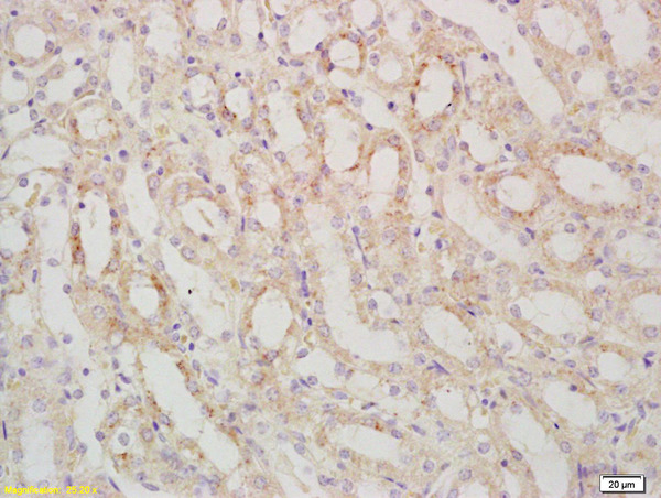 Formalin-fixed and paraffin embedded mouse kidney labeled with Rabbit Anti SARM1 Polyclonal Antibody, Unconjugated (bs-9001R) at 1:200 followed by conjugation to the secondary antibody and DAB staining