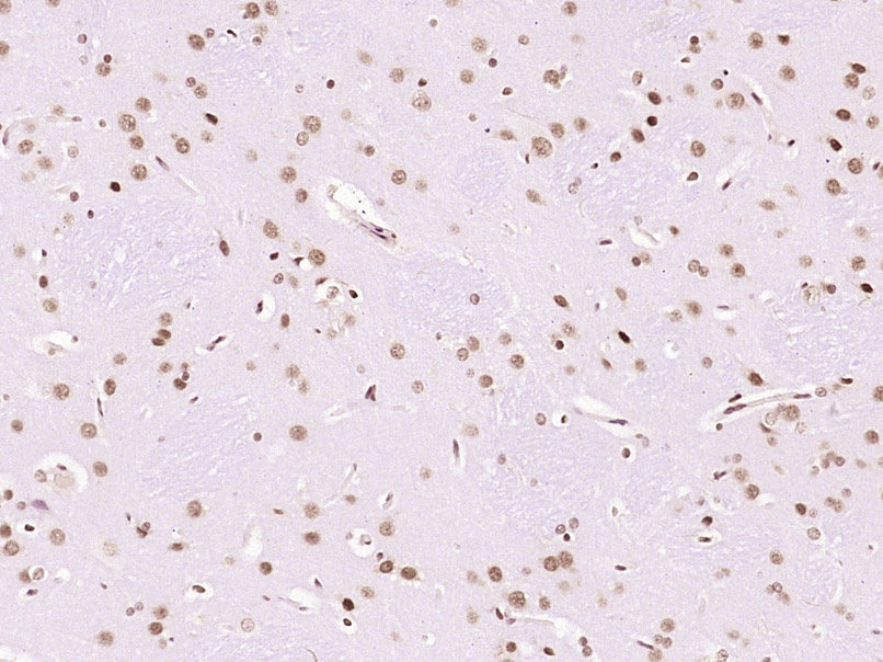 Paraformaldehyde-fixed, paraffin embedded Rat brain; Antigen retrieval by boiling in sodium citrate buffer (pH6.0) for 15min; Block endogenous peroxidase by 3% hydrogen peroxide for 20 minutes; Blocking buffer (normal goat serum) at 37°C for 30min; Antibody incubation with LMX1b/NPS1 Polyclonal Antibody, Unconjugated (bs-11780R) at 1:400 overnight at 4°C, DAB staining.