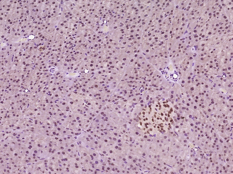 Paraformaldehyde-fixed, paraffin embedded Mouse pancreas; Antigen retrieval by boiling in sodium citrate buffer (pH6.0) for 15min; Block endogenous peroxidase by 3% hydrogen peroxide for 20 minutes; Blocking buffer (normal goat serum) at 37°C for 30min; Antibody incubation with LMX1b/NPS1 Polyclonal Antibody, Unconjugated (bs-11780R) at 1:400 overnight at 4°C, DAB staining.