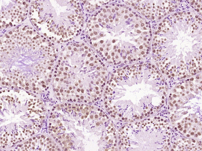 Paraformaldehyde-fixed, paraffin embedded Mouse testis; Antigen retrieval by boiling in sodium citrate buffer (pH6.0) for 15min; Block endogenous peroxidase by 3% hydrogen peroxide for 20 minutes; Blocking buffer (normal goat serum) at 37°C for 30min; Antibody incubation with LMX1b/NPS1 Polyclonal Antibody, Unconjugated (bs-11780R) at 1:400 overnight at 4°C, DAB staining.