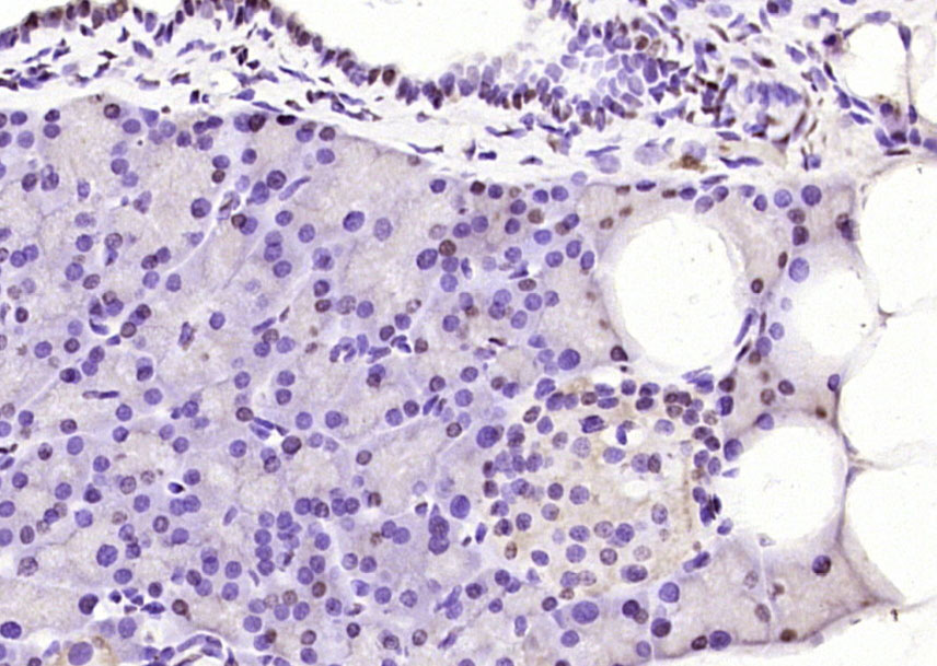 Paraformaldehyde-fixed, paraffin embedded Rat pancreas; Antigen retrieval by boiling in sodium citrate buffer (pH6.0) for 15min; Block endogenous peroxidase by 3% hydrogen peroxide for 20 minutes; Blocking buffer (normal goat serum) at 37°C for 30min; Antibody incubation with LMX1b/NPS1 Polyclonal Antibody, Unconjugated (bs-11780R) at 1:400 overnight at 4°C, DAB staining.