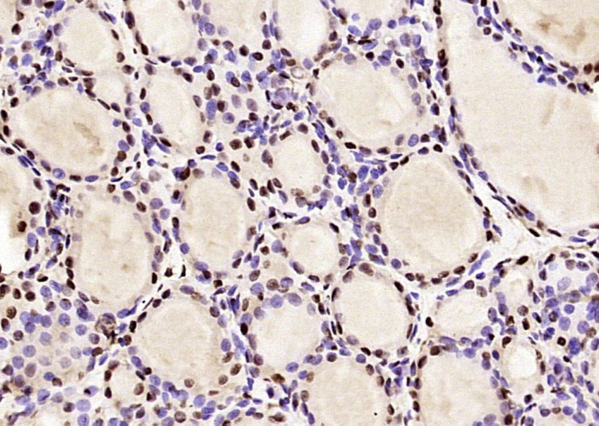 Paraformaldehyde-fixed, paraffin embedded Rat thyroid gland; Antigen retrieval by boiling in sodium citrate buffer (pH6.0) for 15min; Block endogenous peroxidase by 3% hydrogen peroxide for 20 minutes; Blocking buffer (normal goat serum) at 37°C for 30min; Antibody incubation with LMX1b/NPS1 Polyclonal Antibody, Unconjugated (bs-11780R) at 1:400 overnight at 4°C, DAB staining.