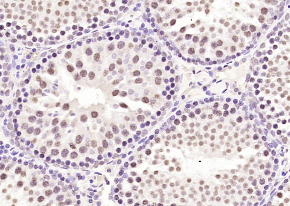 Paraformaldehyde-fixed, paraffin embedded Rat testis; Antigen retrieval by boiling in sodium citrate buffer (pH6.0) for 15min; Block endogenous peroxidase by 3% hydrogen peroxide for 20 minutes; Blocking buffer (normal goat serum) at 37°C for 30min; Antibody incubation with LMX1b/NPS1 Polyclonal Antibody, Unconjugated (bs-11780R) at 1:400 overnight at 4°C, DAB staining.