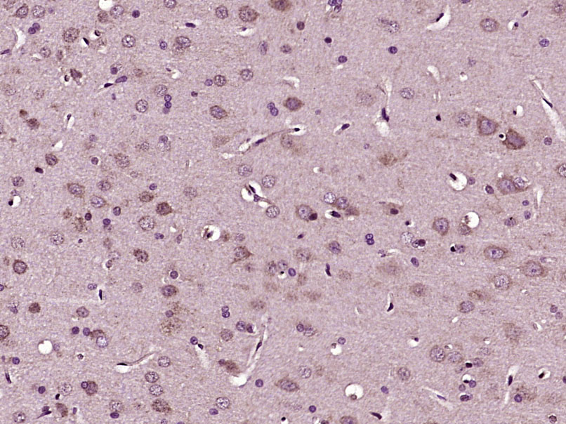 Paraformaldehyde-fixed, paraffin embedded Rat brain; Antigen retrieval by boiling in sodium citrate buffer (pH6.0) for 15min; Block endogenous peroxidase by 3% hydrogen peroxide for 20 minutes; Blocking buffer (normal goat serum) at 37°C for 30min; Antibody incubation with RhoA/C Polyclonal Antibody, Unconjugated (bs-1180R) at 1:400 overnight at 4°C, DAB staining.