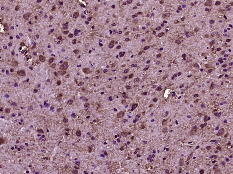 Paraformaldehyde-fixed, paraffin embedded Mouse brain; Antigen retrieval by boiling in sodium citrate buffer (pH6.0) for 15min; Block endogenous peroxidase by 3% hydrogen peroxide for 20 minutes; Blocking buffer (normal goat serum) at 37°C for 30min; Antibody incubation with RhoA/C Polyclonal Antibody, Unconjugated (bs-1180R) at 1:400 overnight at 4°C, DAB staining.
