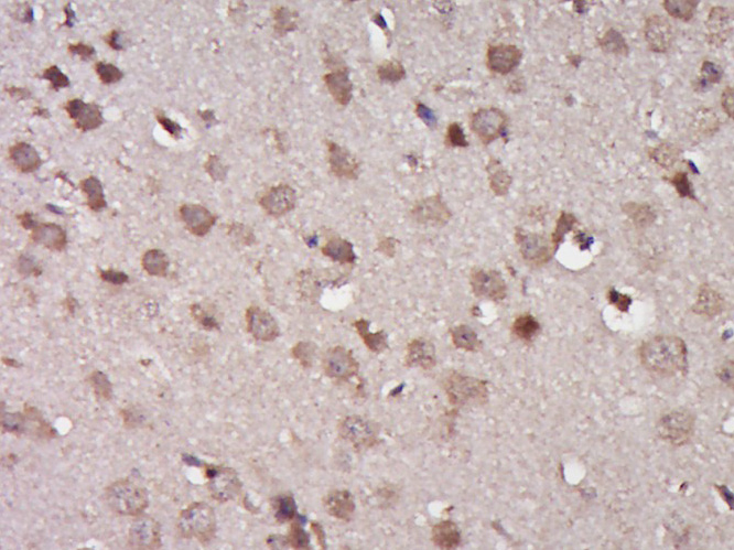 Paraformaldehyde-fixed, paraffin embedded Mouse brain; Antigen retrieval by boiling in sodium citrate buffer (pH6.0) for 15min; Block endogenous peroxidase by 3% hydrogen peroxide for 20 minutes; Blocking buffer (normal goat serum) at 37°C for 30min; Antibody incubation with TRAF3 Polyclonal Antibody, Unconjugated (bs-1185R) at 1:400 overnight at 4°C, DAB staining.