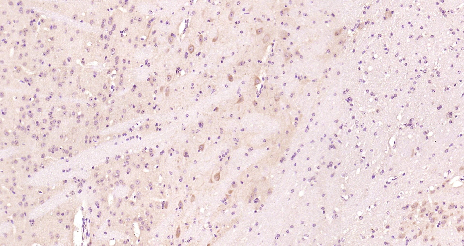 Paraformaldehyde-fixed, paraffin embedded Mouse brain; Antigen retrieval by boiling in sodium citrate buffer (pH6.0) for 15min; Block endogenous peroxidase by 3% hydrogen peroxide for 20 minutes; Blocking buffer (normal goat serum) at 37°C for 30min; Antibody incubation with Cyclooxygenase 2 Polyclonal Antibody, Unconjugated (bs-0732R) at 1:200 overnight at 4°C, DAB staining.