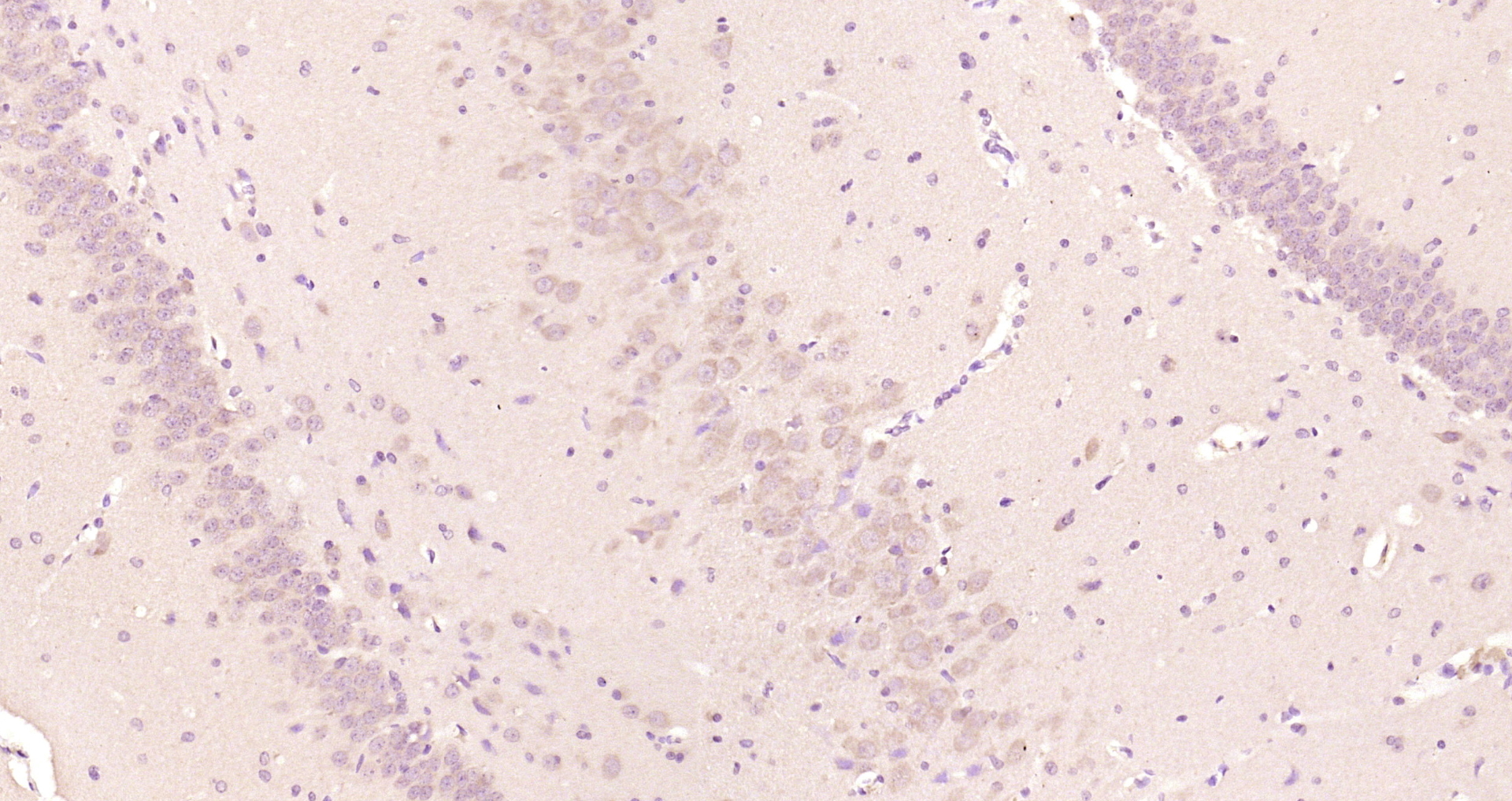 Paraformaldehyde-fixed, paraffin embedded Rat brain; Antigen retrieval by boiling in sodium citrate buffer (pH6.0) for 15min; Block endogenous peroxidase by 3% hydrogen peroxide for 20 minutes; Blocking buffer (normal goat serum) at 37°C for 30min; Antibody incubation with Cyclooxygenase 2 Polyclonal Antibody, Unconjugated (bs-0732R) at 1:200 overnight at 4°C, DAB staining.