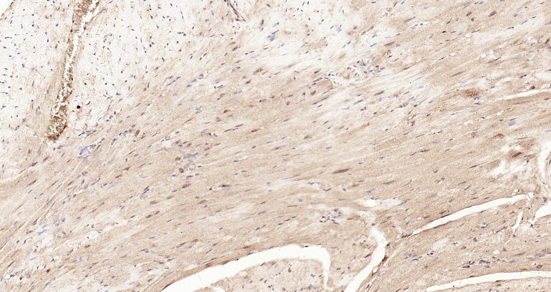 Paraformaldehyde-fixed, paraffin embedded Mouse heart; Antigen retrieval by boiling in sodium citrate buffer (pH6.0) for 15min; Block endogenous peroxidase by 3% hydrogen peroxide for 20 minutes; Blocking buffer (normal goat serum) at 37°C for 30min; Antibody incubation with STAT3 (Tyr705) Polyclonal Antibody, Unconjugated (bs-1658R) at 1:200 overnight at 4°C, DAB staining.