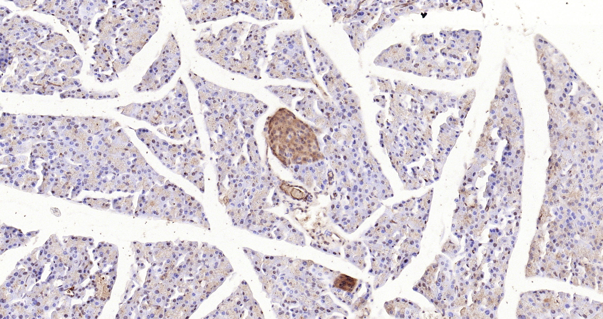 Paraformaldehyde-fixed, paraffin embedded Mouse pancreas; Antigen retrieval by boiling in sodium citrate buffer (pH6.0) for 15min; Block endogenous peroxidase by 3% hydrogen peroxide for 20 minutes; Blocking buffer (normal goat serum) at 37°C for 30min; Antibody incubation with STAT3 (Tyr705) Polyclonal Antibody, Unconjugated (bs-1658R) at 1:200 overnight at 4°C, DAB staining.