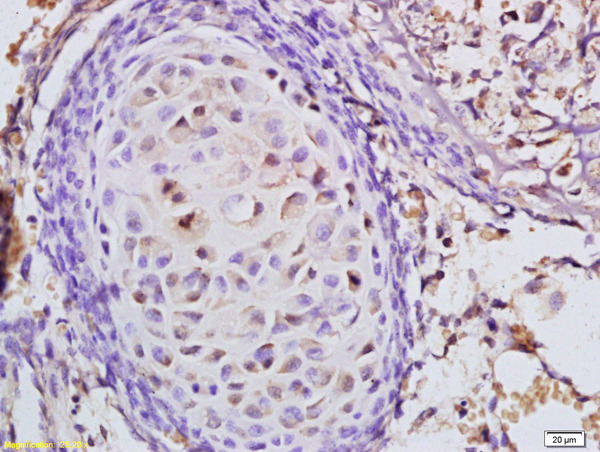 Formalin-fixed and paraffin embedded mouse embryo tissue labeled with Anti-CARM1 Polyclonal Antibody, Unconjugated (bs-4098R) at 1:200 followed by conjugation to the secondary antibody