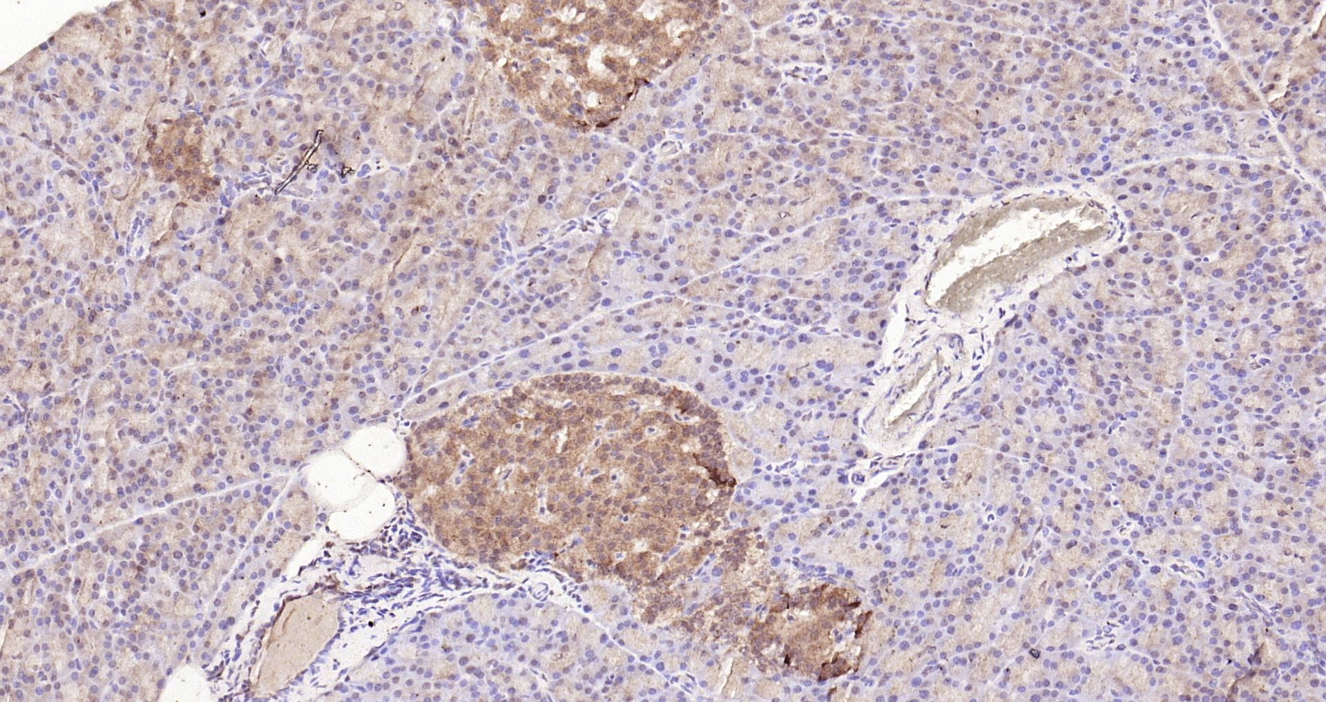 Paraformaldehyde-fixed, paraffin embedded Rat pancreas; Antigen retrieval by boiling in sodium citrate buffer (pH6.0) for 15min; Block endogenous peroxidase by 3% hydrogen peroxide for 20 minutes; Blocking buffer (normal goat serum) at 37°C for 30min; Antibody incubation with STAT3 (Tyr705) Polyclonal Antibody, Unconjugated (bs-1658R) at 1:200 overnight at 4°C, DAB staining.