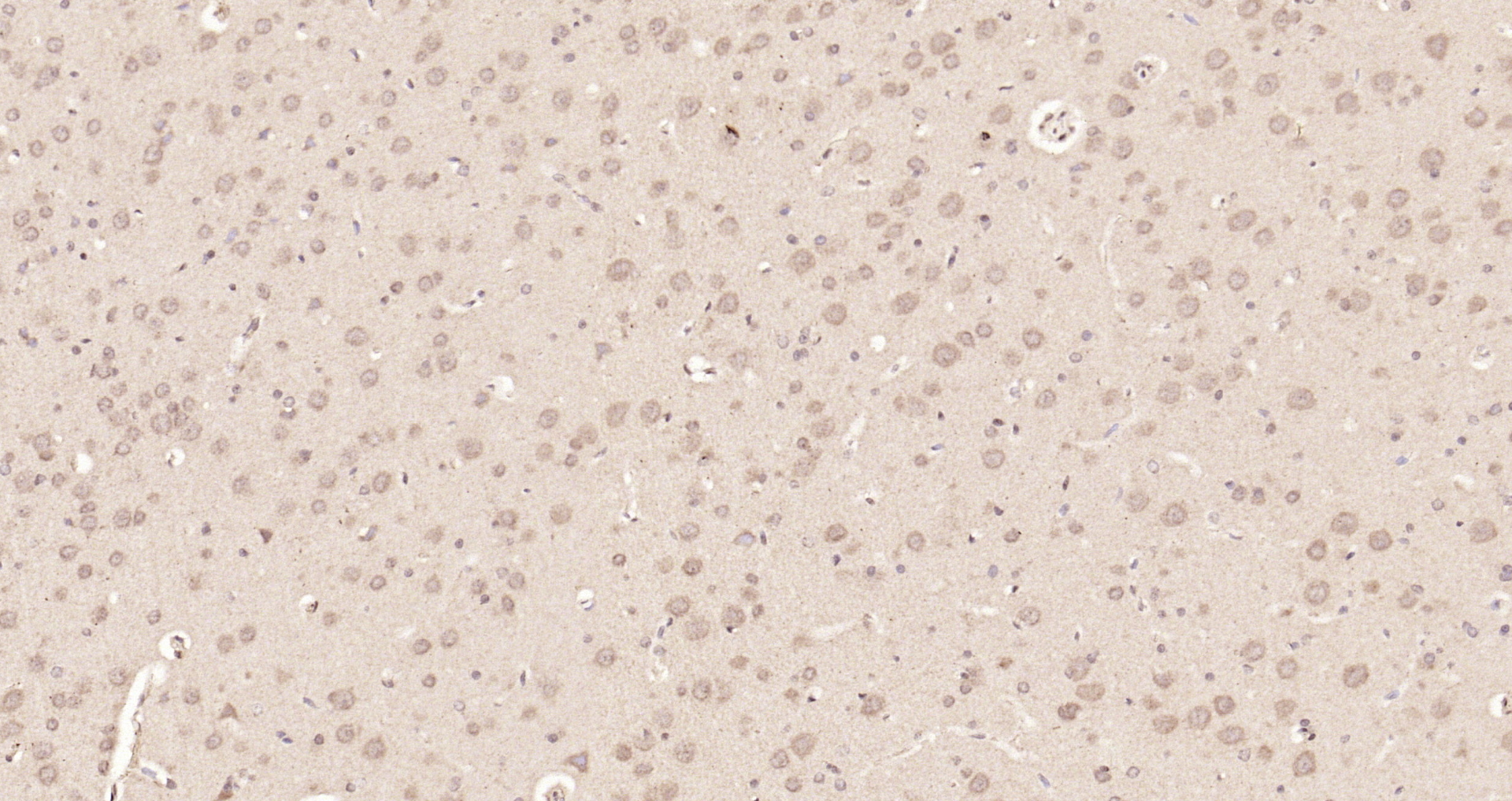 Paraformaldehyde-fixed, paraffin embedded Rat brains; Antigen retrieval by boiling in sodium citrate buffer (pH6.0) for 15min; Block endogenous peroxidase by 3% hydrogen peroxide for 20 minutes; Blocking buffer (normal goat serum) at 37°C for 30min; Antibody incubation with STAT3 (Tyr705) Polyclonal Antibody, Unconjugated (bs-1658R) at 1:200 overnight at 4°C, DAB staining.