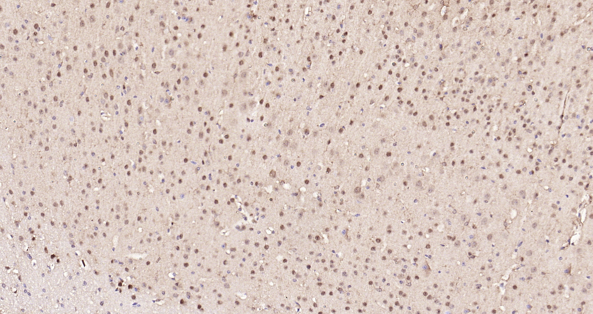 Paraformaldehyde-fixed, paraffin embedded Mouse brain; Antigen retrieval by boiling in sodium citrate buffer (pH6.0) for 15min; Block endogenous peroxidase by 3% hydrogen peroxide for 20 minutes; Blocking buffer (normal goat serum) at 37°C for 30min; Antibody incubation with GAPDH Polyclonal Antibody, Unconjugated (bs-10900R) at 1:200 overnight at 4°C, DAB staining.