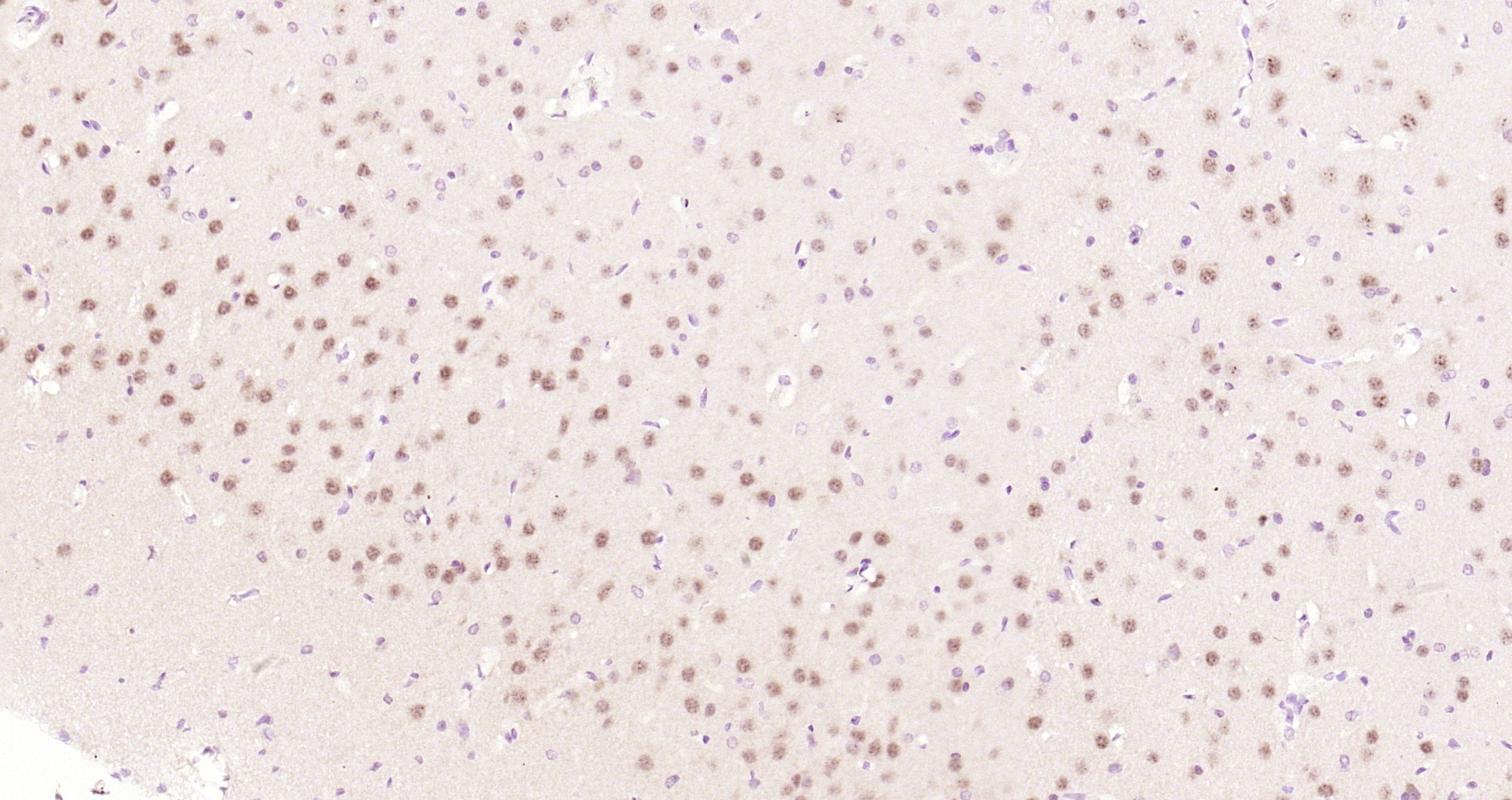 Paraformaldehyde-fixed, paraffin embedded Rat brain; Antigen retrieval by boiling in sodium citrate buffer (pH6.0) for 15min; Block endogenous peroxidase by 3% hydrogen peroxide for 20 minutes; Blocking buffer (normal goat serum) at 37°C for 30min; Antibody incubation with GAPDH Polyclonal Antibody, Unconjugated (bs-10900R) at 1:200 overnight at 4°C, DAB staining.