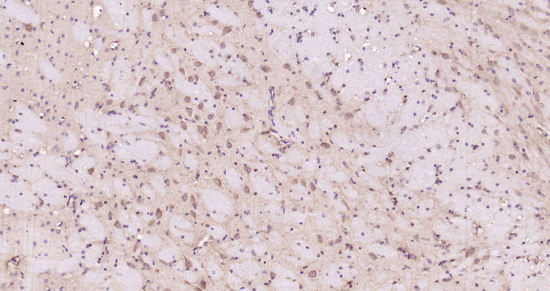 Paraformaldehyde-fixed, paraffin embedded Mouse brain; Antigen retrieval by boiling in sodium citrate buffer (pH6.0) for 15min; Block endogenous peroxidase by 3% hydrogen peroxide for 20 minutes; Blocking buffer (normal goat serum) at 37°C for 30min; Antibody incubation with STAT3 (3F5) Monoclonal Antibody, Unconjugated (bsm-33218M) at 1:200 overnight at 4°C, DAB staining.